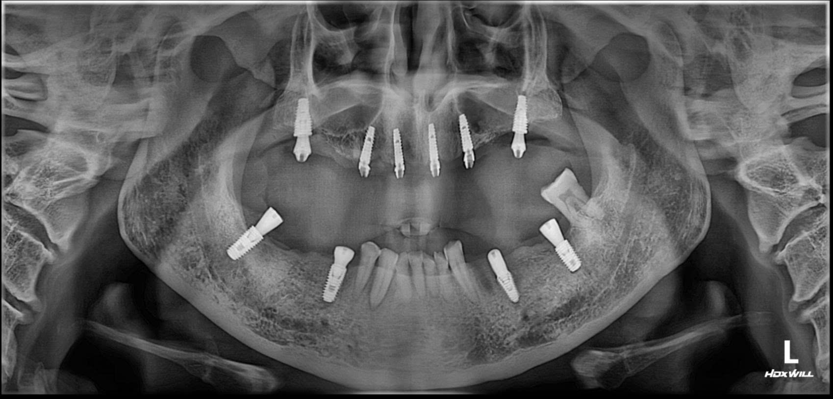 z7146702415734_e2c7467ec5d631f1e4d9c79f2d8eeb1f